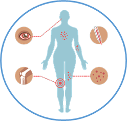 Symptoms of Zika